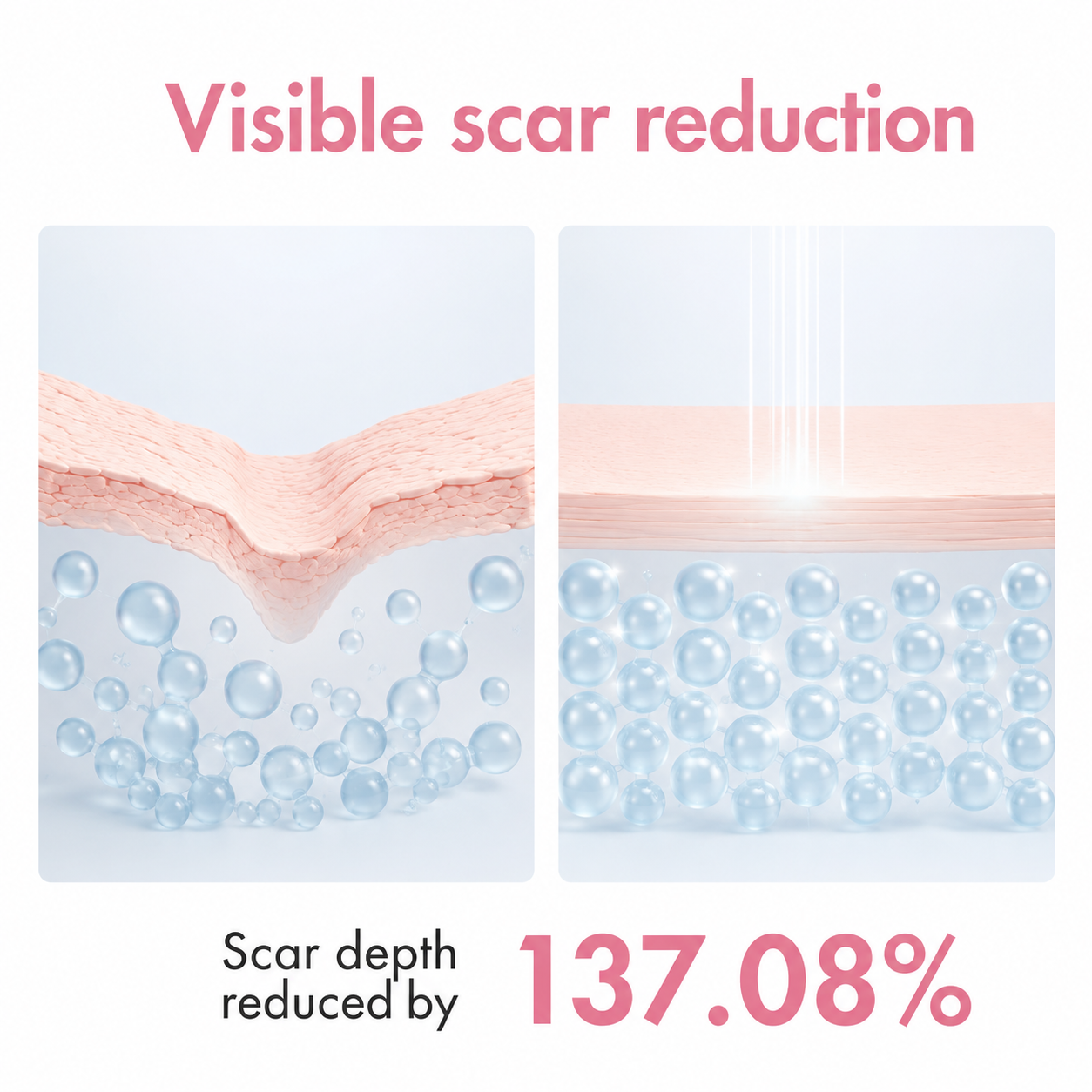 Visible scar reduction — scar depth reduced by 137.08%